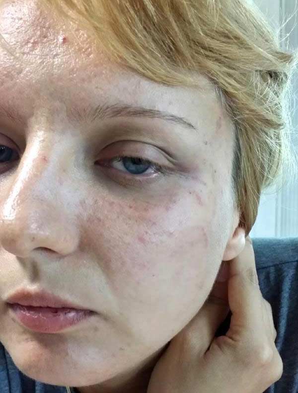 Yabancı gelin de aile içi şiddet mağduru