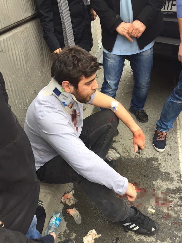 Ünlü sanatçının yeğeni kaza yaptı!