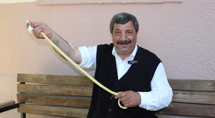 Elini ısıran yılanla hastaneye gitti