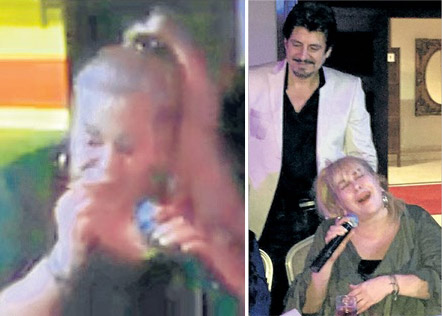 Zerrin Özer takma dişini düşürdü