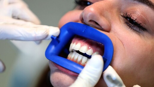 İnternette satılan diş beyazlatma kitleri için uyarı - Sağlık