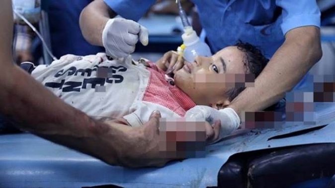 Yemen&#039;deki acının sembolü 6 yaşındaki Ferid Şevki hayatını kaybetti
