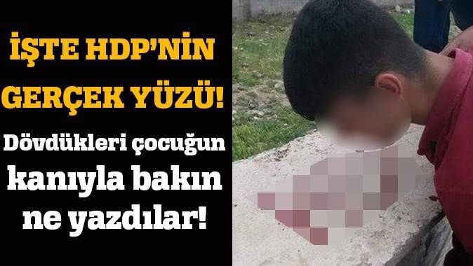 Dövdükleri çocuğun kanıyla HDP yazdılar