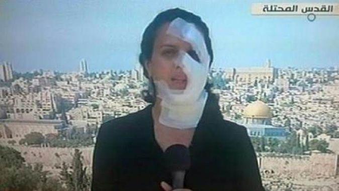 İşgalci İsrail güçleri, canlı yayında gazeteci vurdu