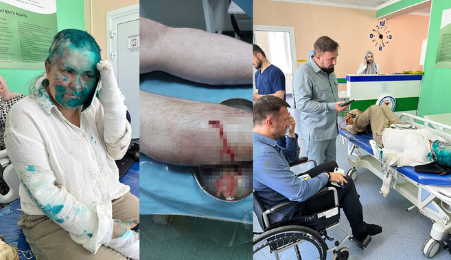 Çeçenistan&#039;da Rus gazeteci ve avukata korkunç saldırı! Kadirov&#039;dan açıklama geldi