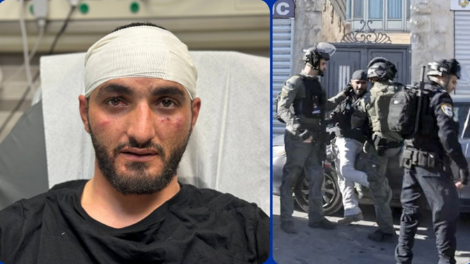 ABD Dışişleri Bakanlığı: Doğu Kudüs&#039;te AA muhabirine saldıran İsrailli polis hesap vermeli