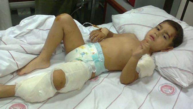 Başı boş Rottweiler&#039;ın saldırdığı küçük çocuk hastanede