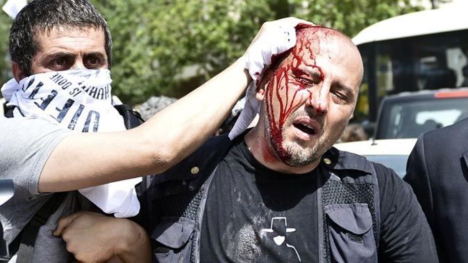 Gezi Parkı&#039;nda Ahmet Şık da yaralandı