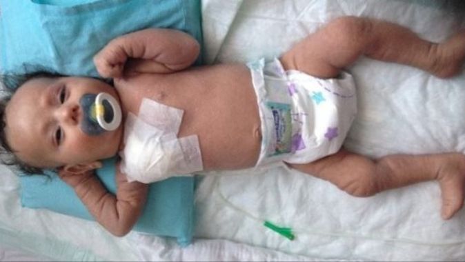 İlik nakli yapılan Talha bebekten kötü haber var