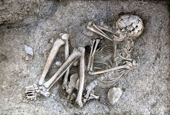 3200 yaşındaki iskelette kanser izlerine rastlandı