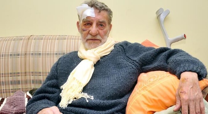 Ahmet Mekin kaza geçirdi