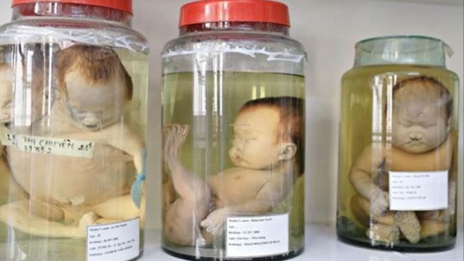 Kavanozdaki ölü bebekler ülkesi Vietnam
