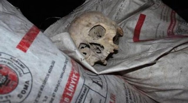Çöpte bulunan kafatasının sırrı açıklandı