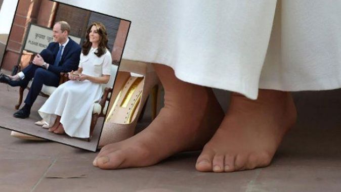 İngiltere&#039;nin gündemi, &#039;Kate Middleton&#039;ın nasırlı ayakları&#039;