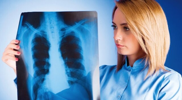 Akciğer kanserinde umut bağışıklık sistemi