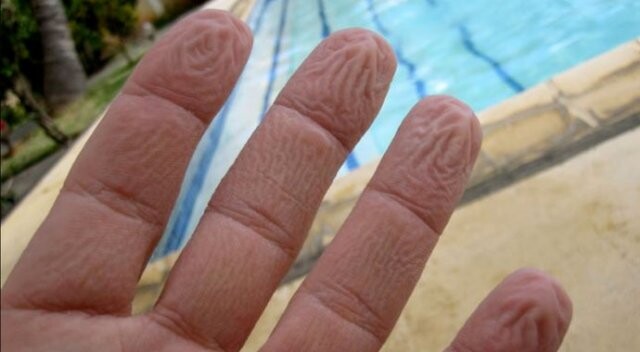 Parmaklar neden buruşur?
