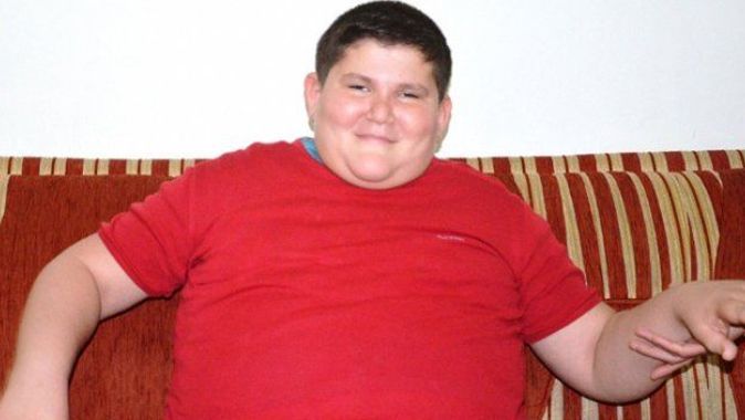 Dramı yürek burkuyor: 13 yaşında 122 kilo !