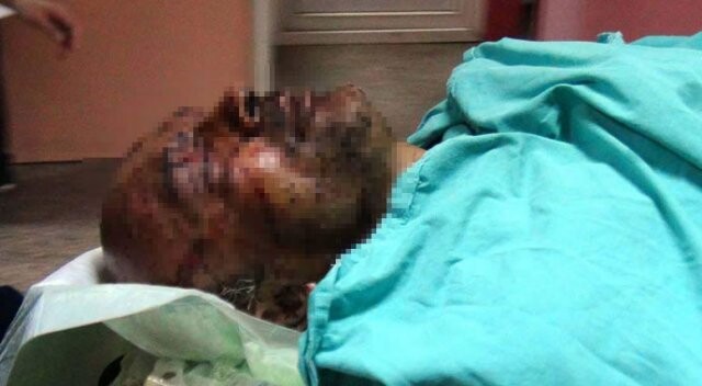 Fethiye&#039;de esrarengiz patlama: 3 yaralı