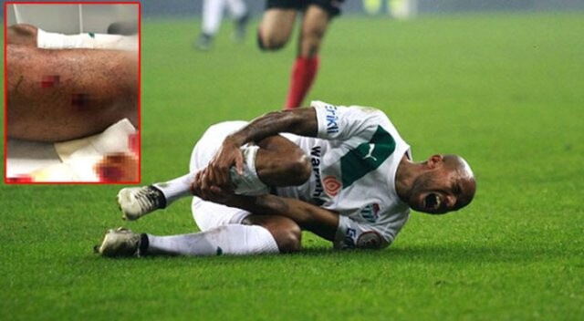 Bursasporlu Josua&#039;nın bacağına 12 dikiş atıldı