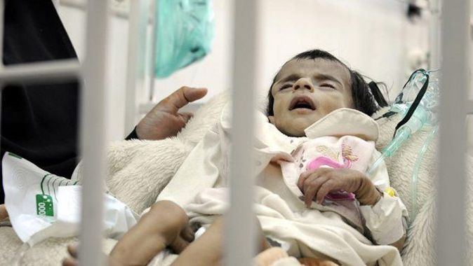Yemen&#039;de yarım milyon çocuk ölüm tehlikesiyle karşı karşıya