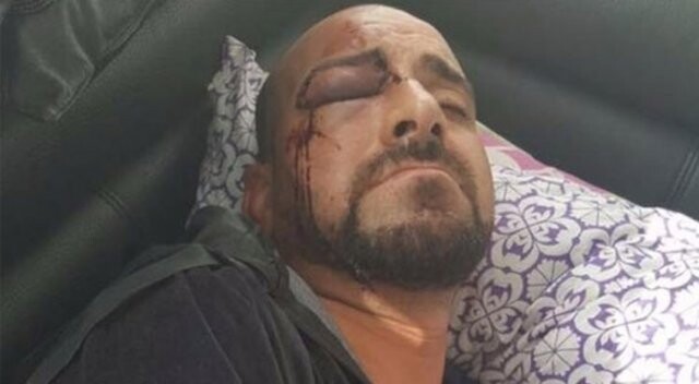 Belçika&#039;da bir Türk vatandaşı Irkçılar tarafından feci şekilde dövüldü