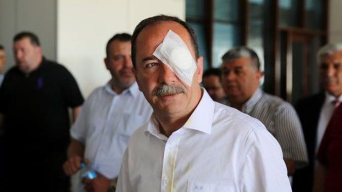 Selfie çektirirken yumurtayı CHP&#039;li başkanın gözüne vurdu