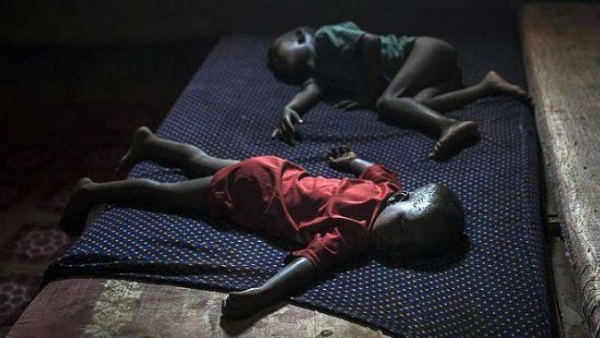 Somali&#039;de kolera 700 kişinin ölümüne neden oldu