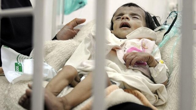 Yemen&#039;deki kolera salgınında ölenlerin sayısı 789&#039;a yükseldi