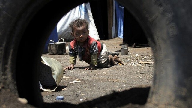 Yemen&#039;de 7 milyon kişi açlık tehlikesiyle karşı karşıya