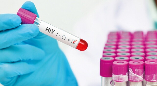 HIV kendini 10 yıl saklayabilir