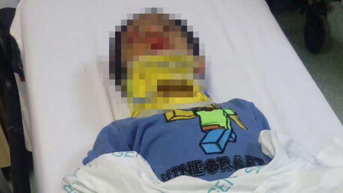 Otomobilin çarptığı 5 yaşındaki çocuk yaralandı