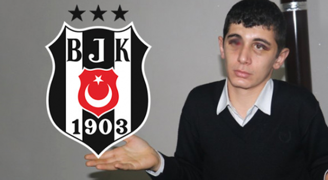Beşiktaş&#039;tan saldırıya uğrayan engelli gence davet