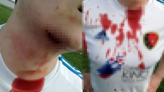 Taraftar sahaya girip futbolcunun boğazını kesti!