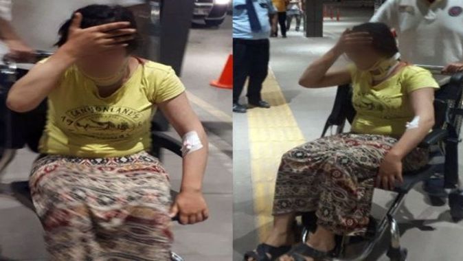 Kayınpederi tarafından dövülen 17 yaşındaki kız polise sığındı