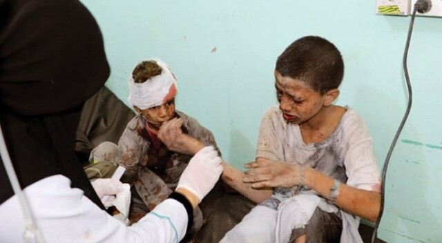 Yemen&#039;de hava saldırısı: Onlarca ölü