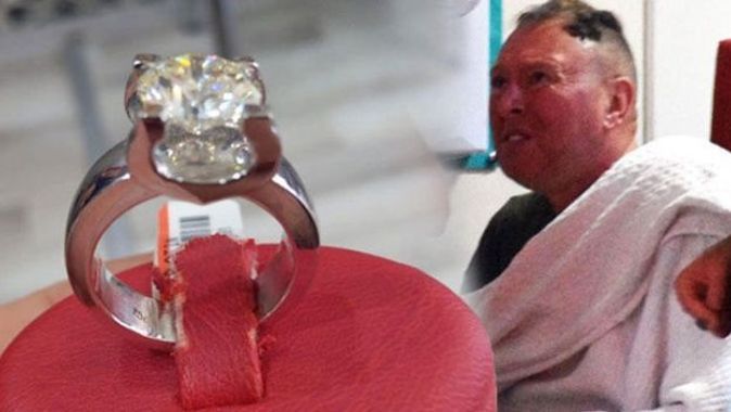 Akıl almaz olay… Turist 40 bin dolarlık yüzüğü yutunca…