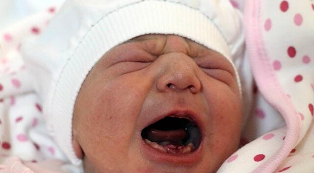 Amasya&#039;da dokuz dişli bebek dünyaya geldi