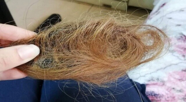 Hasta yakını genç kızın sağlık çalışanını darp edip saçını kopardığı iddiası
