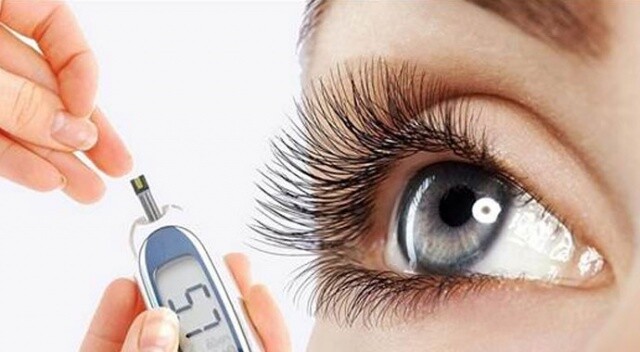 Şeker hastalığı gözlerde önemli hasarlara yol açıyor