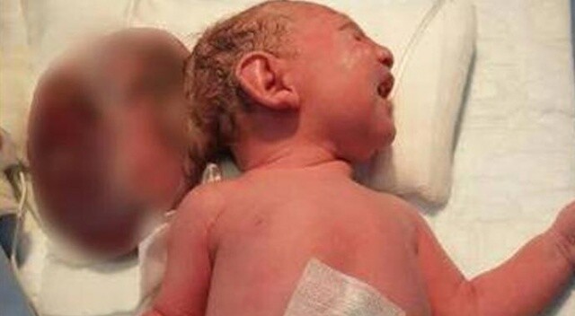2 aylık Elif bebek ameliyat edildi