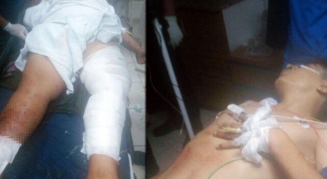 Tarsus’ta kar maskeliler tarafından silahlı saldırı: 2’si ağır 4 çocuk yaralandı