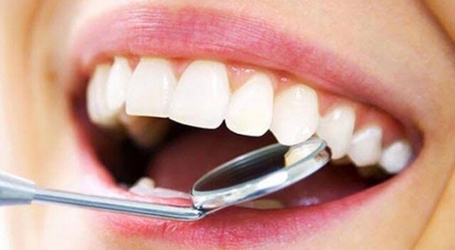 Diş beyazlatma yaptırırken dikkat!