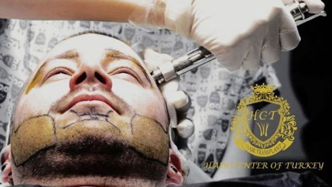 Hair Center of Turkey&#039;de ağrısız ve tıraşsız saç ekimi ayrıcalıklarını yaşayın