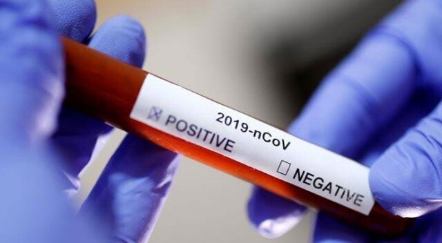 İspanya&#039;da ilk koronavirüs vakası tespit edildi