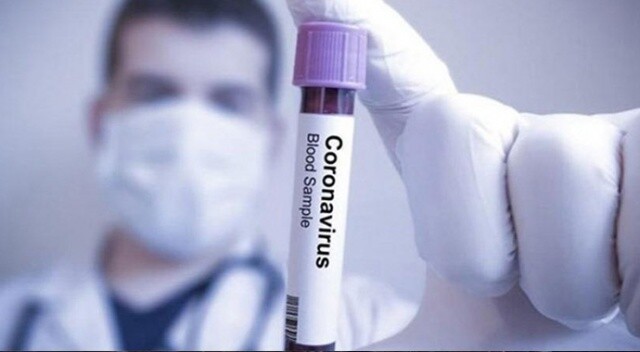 Japonya&#039;da koronavirüsü vaka sayısı 731&#039;e yükseldi