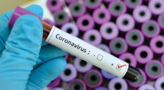 Koronavirüs bir ülkede daha tespit edildi