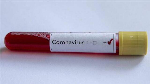 Azerbaycan&#039;da koronavirüsü vakası 9’a yükseldi