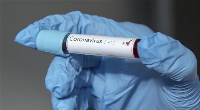 Dünyada koronavirüs sebebiyle ölenlerin sayısı 18 bin 900&#039;ü aştı