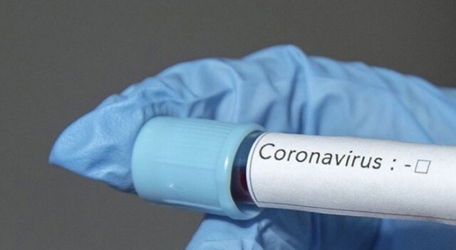 Dünyada yeni tip koronavirüs nedeniyle ölenlerin sayısı 11 bini aştı