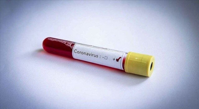 Hollanda&#039;da koronavirüs nedeniyle hayatını kaybedenlerin sayısı 771&#039;e yükseldi